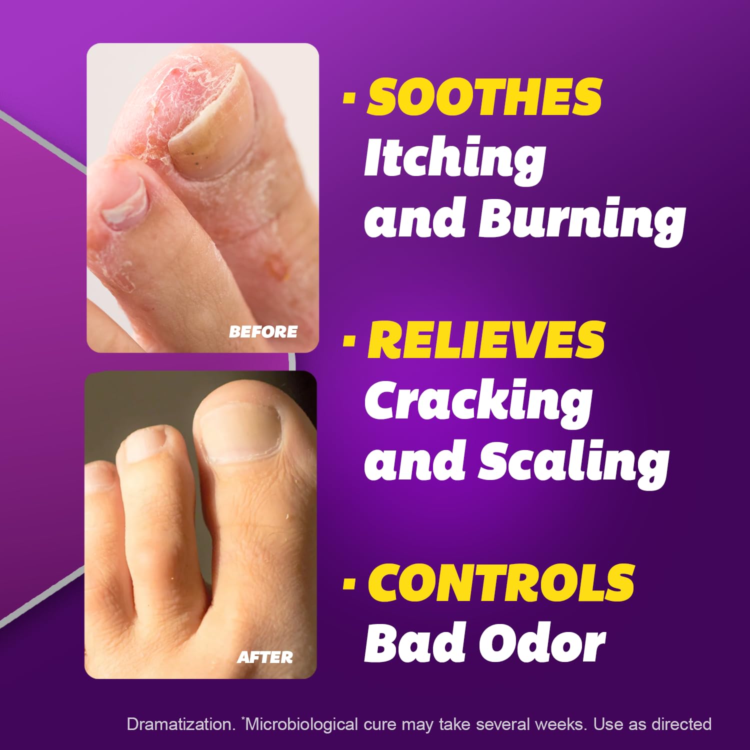 Silka Antifungal Cream, Clinical Anti-Fungus Foot Treatment, Results in 1 Week, Maximum Strength Athlete’s Foot Treatment, Jock Itch, Ringworm Treatment for Humans, Terbinafine Cream, 1oz- 2 Pack