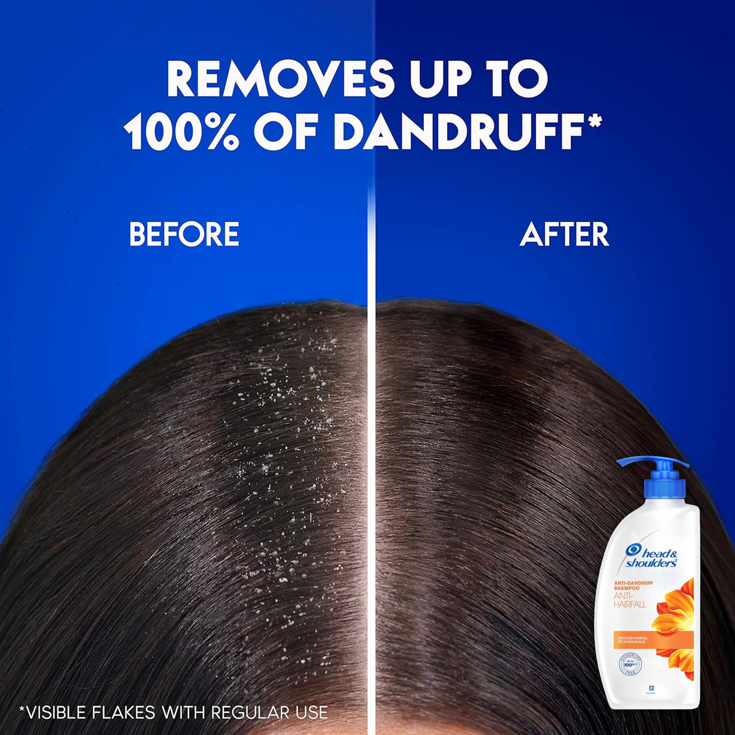 Head & Shoulders Anti Hair fall Shampoo, 2 Pack Anti Dandruff Shampoo, Relieves Dry Scalp and Repairs Damage, Fresh Scent, 22 oz Pump Bottles