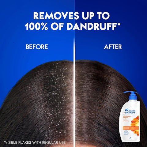 Head & Shoulders Anti Hair fall Shampoo, 2 Pack Anti Dandruff Shampoo, Relieves Dry Scalp and Repairs Damage, Fresh Scent, 22 oz Pump Bottles