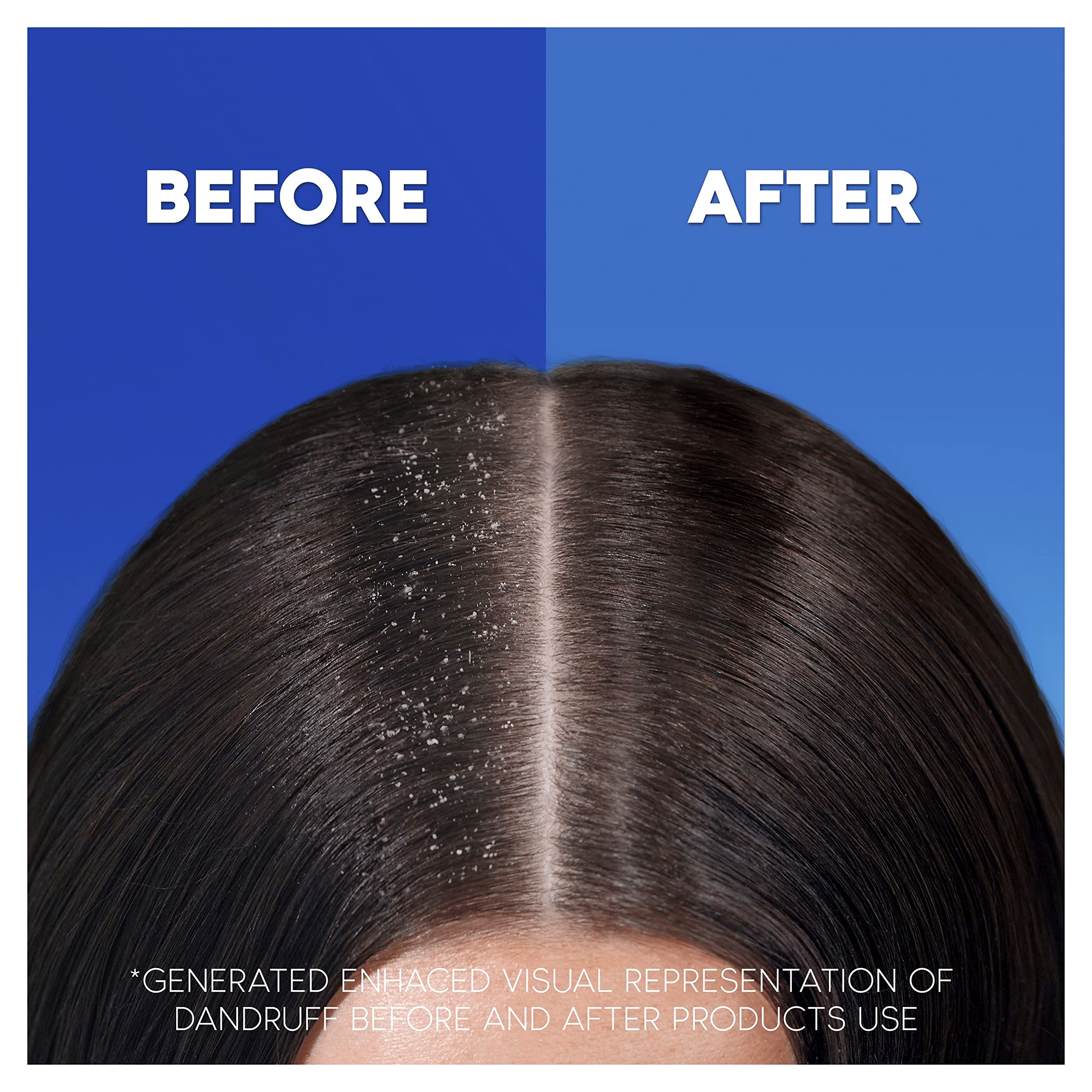 Head & Shoulders Anti-Dandruff Classic Clean Shampoo x 250ml