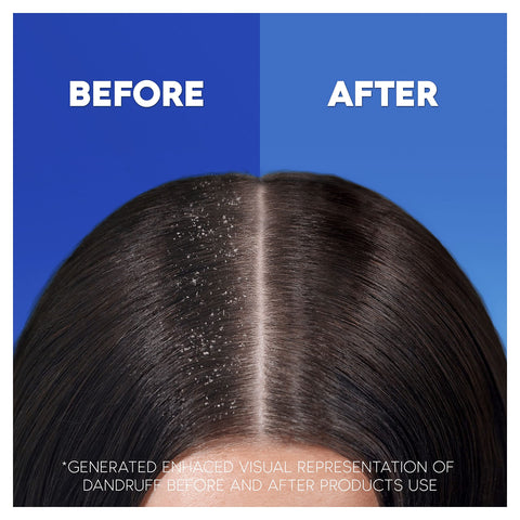 Head & Shoulders Anti-Dandruff Classic Clean Shampoo x 250ml