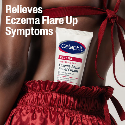CETAPHIL ECZEMA RESTORADERM FLARE-UP RELIEF CREAM, For Eczema Prone Skin, 8 oz, Barrier Repair, 48 Hour Hydration, 2% Skin Protectant Colloidal Oatmeal, Steroid Free
